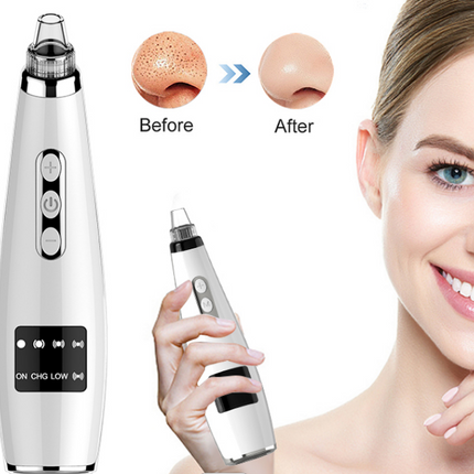 Electric Black Head Suction Instrument Face Cleaner