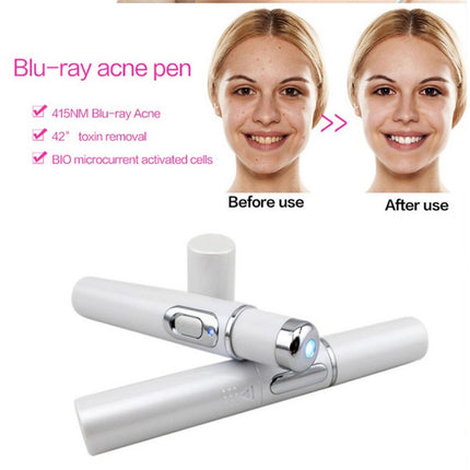 MOQ1  Wrinkle Blemish Pore Acne Scar Remover Pen