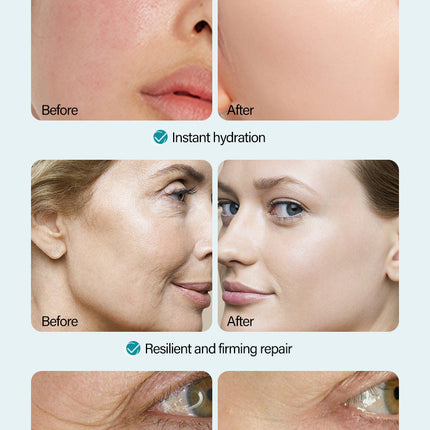 Anti-Wrinkle Face Cream Containing Hyaluronic Acid Hydrating High Moisturizing Fade French