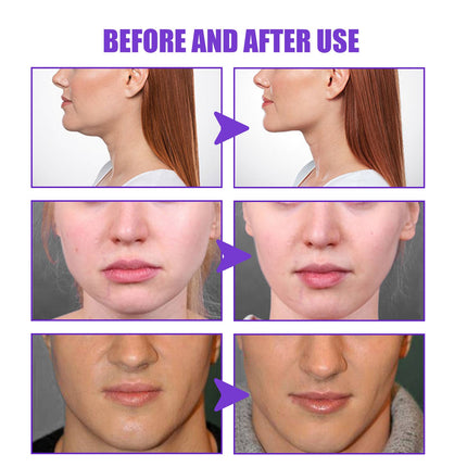Tighten The Contour Lift And Tighten The Chin Face Skin Sagging Massage Cream