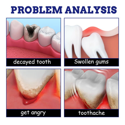 Simple And Creative Gum Swelling Pain Spray